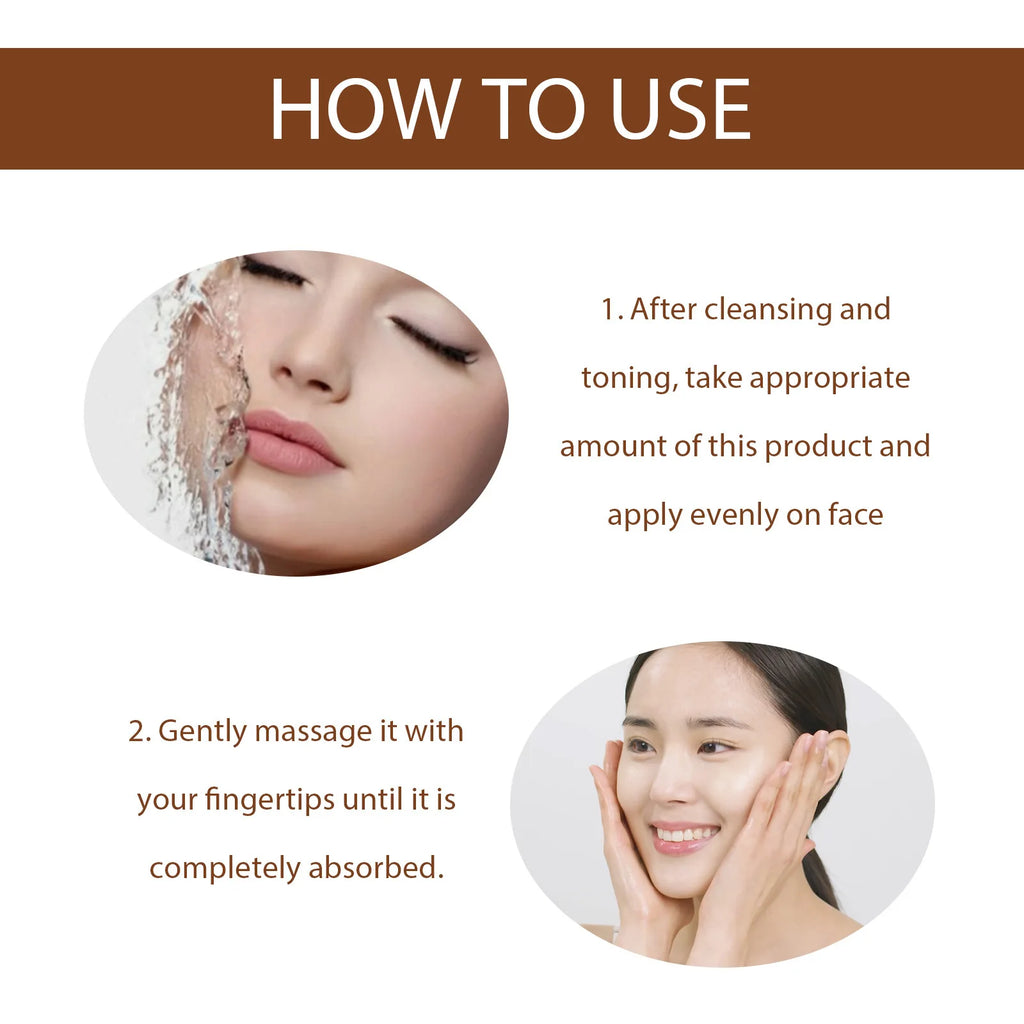 Whitening Freckle Serum Dark Spots Remover Lightening Melasma Melanin Fade Pigmentation Brighten Hydrating Nicotinamide Essence