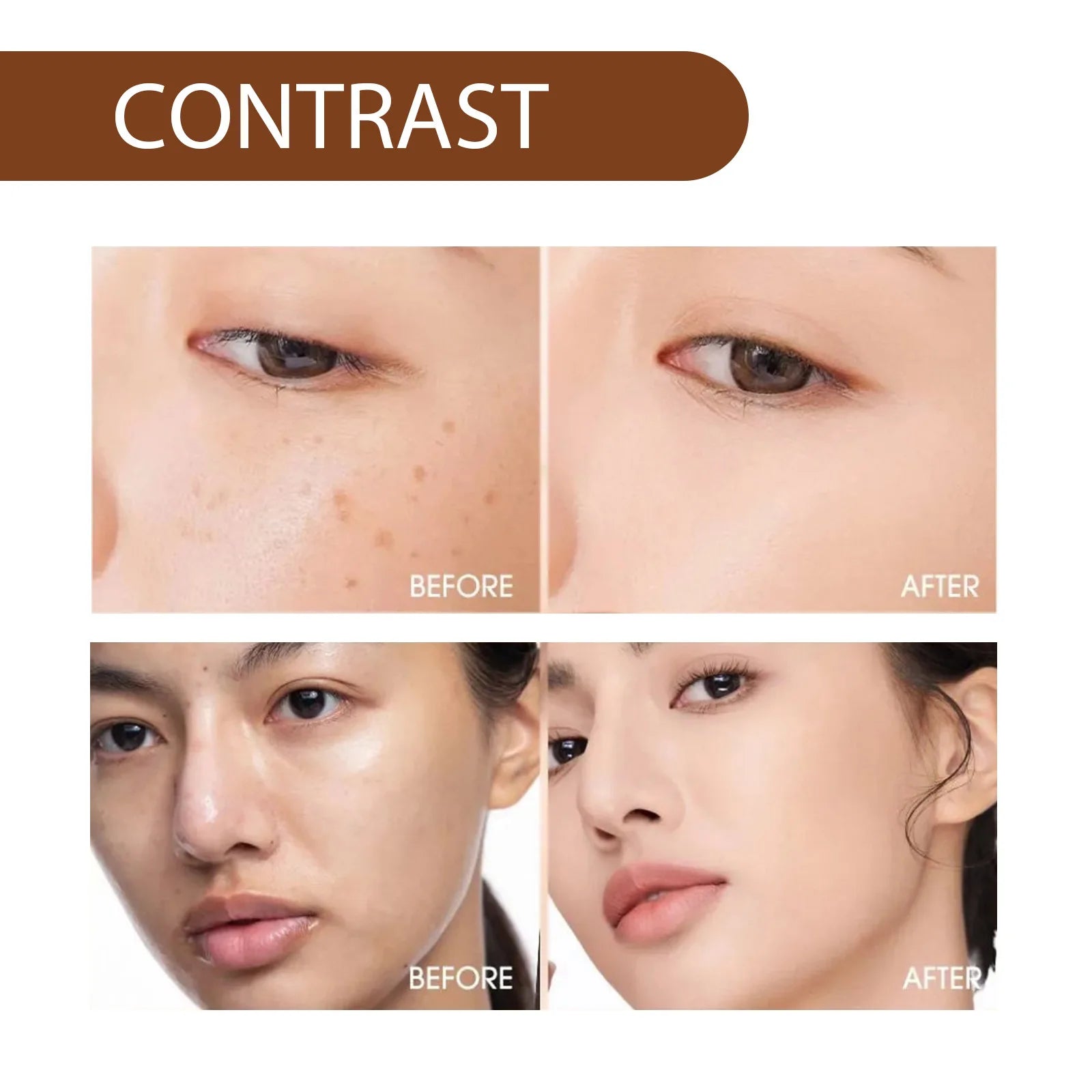 Whitening Freckle Serum Dark Spots Remover Lightening Melasma Melanin Fade Pigmentation Brighten Hydrating Nicotinamide Essence