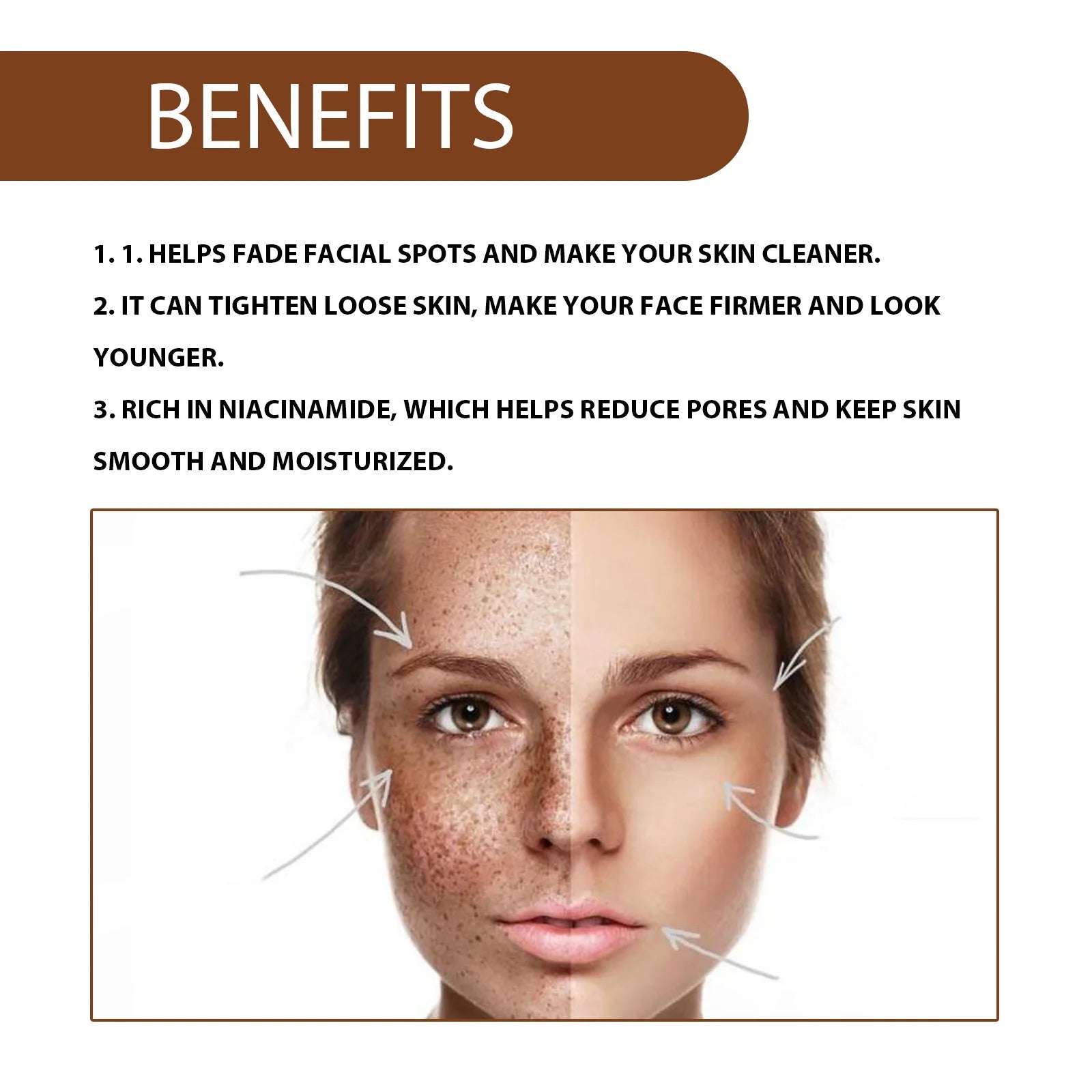 Whitening Freckle Serum Dark Spots Remover Lightening Melasma Melanin Fade Pigmentation Brighten Hydrating Nicotinamide Essence