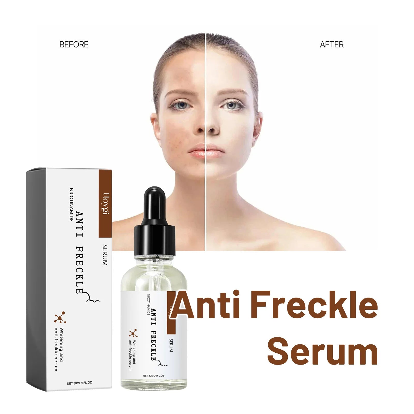 Whitening Freckle Serum Dark Spots Remover Lightening Melasma Melanin Fade Pigmentation Brighten Hydrating Nicotinamide Essence